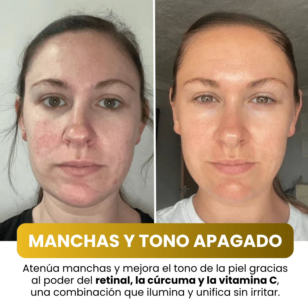 Jayna – Mascarilla Facial Coreana con Cúrcuma y Colágeno