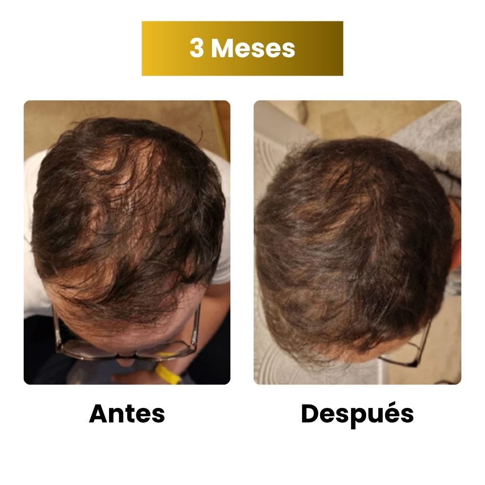 Sérum de crecimiento capilar para hombre (60 ml)