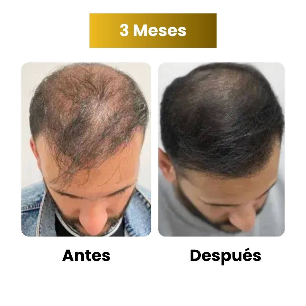 Sérum de crecimiento capilar para hombre (60 ml)