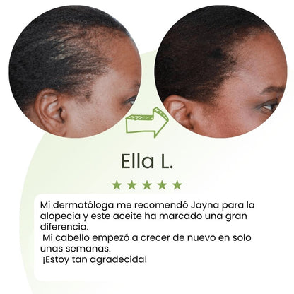 Sérum de crecimiento capilar (60 ml)