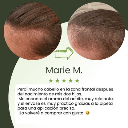 Sérum de crecimiento capilar (60 ml)